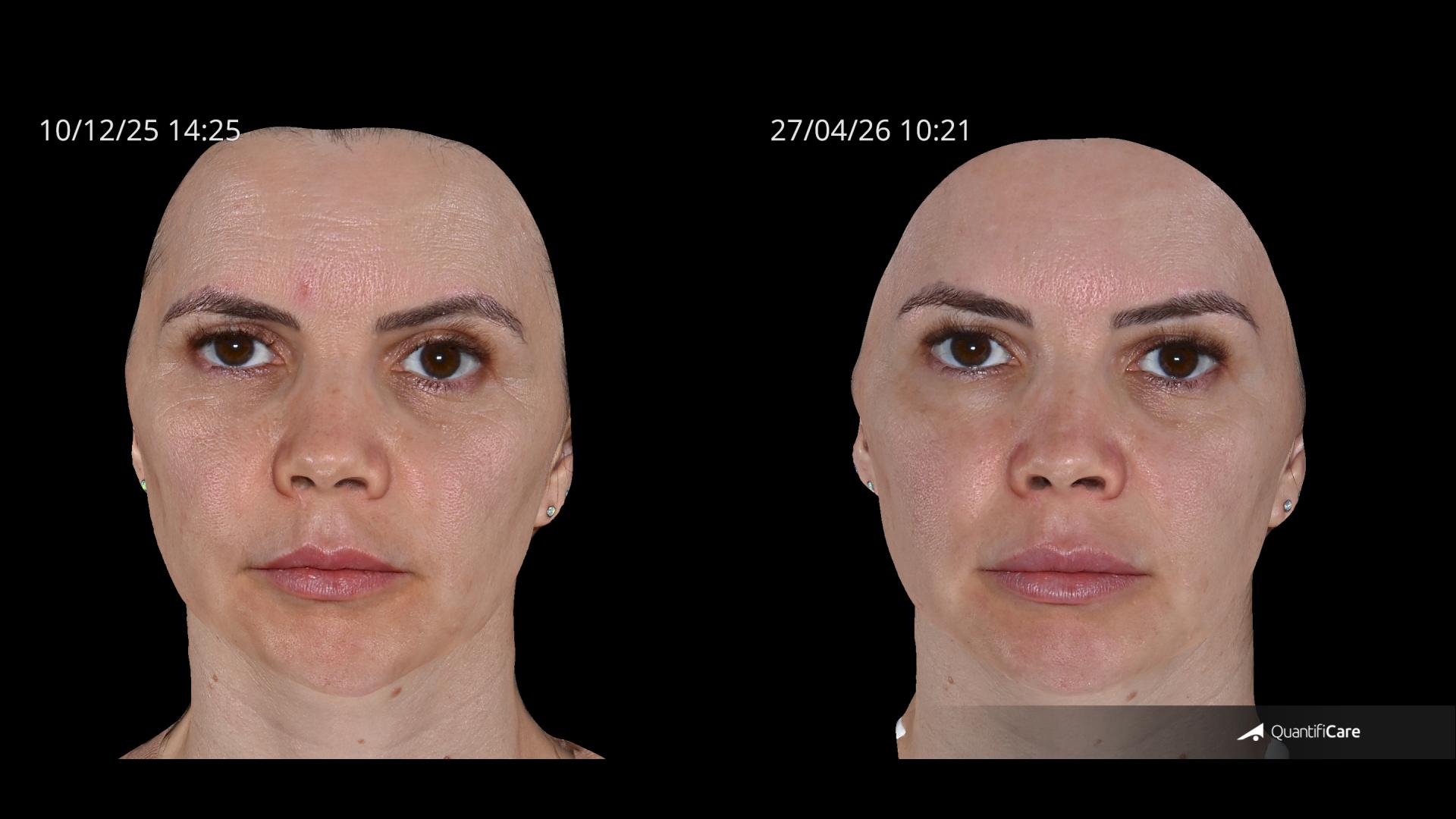 Antes e depois — Documentação em 3D — depois